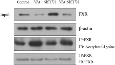 The role of SIRT1-FXR signaling pathway in valproic acid induced liver injury: a quantitative targeted metabolomic evaluation in epileptic children